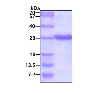 SDS-PAGE: Recombinant Human Retinol Binding Protein RBP His Protein [NBP1-72542]